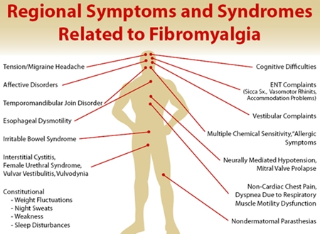 Fibromyalgia