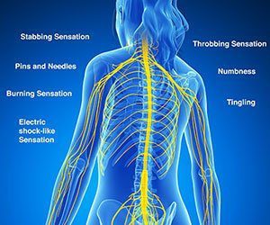 Nerve Pain